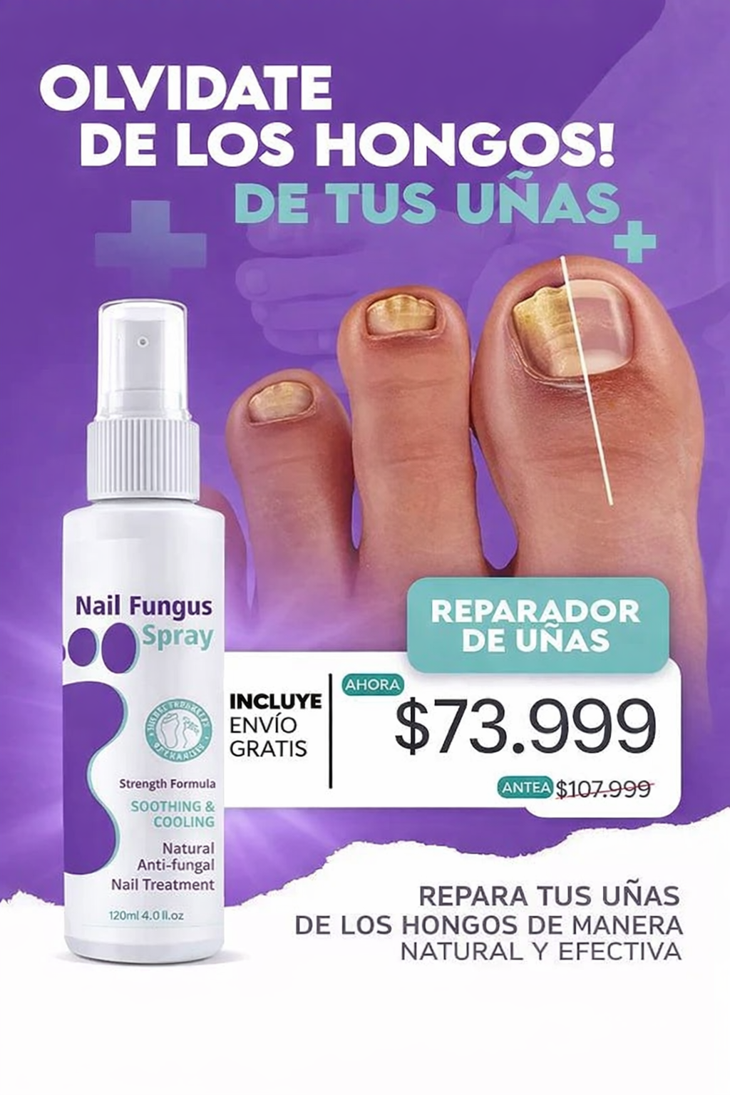 Uñas Sin Hongos