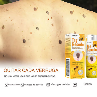 Crema Para Eliminar Verrugas