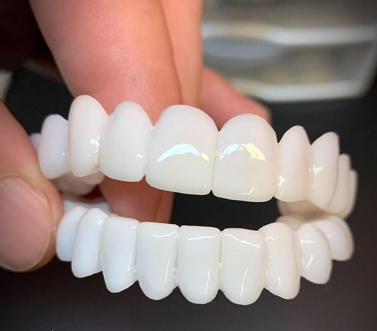 Carillas Dentales Removibles
