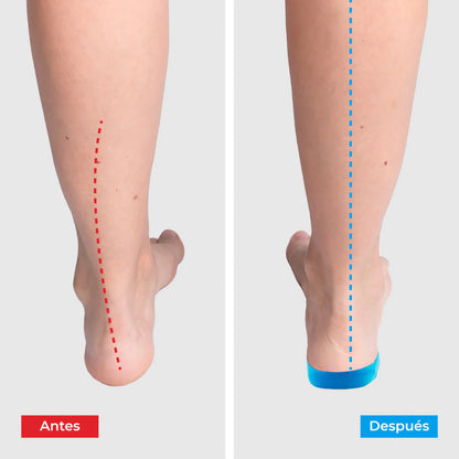 ComfyFeet™: Alivio cómodo y efectivo para tus pies